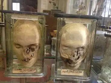 Musée Dupuytren